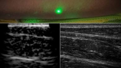 New Laser System Produces Ultrasound Images