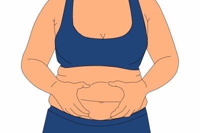 Bariatric Surgery Before Diabetes Leads To Greater Weight Loss Study