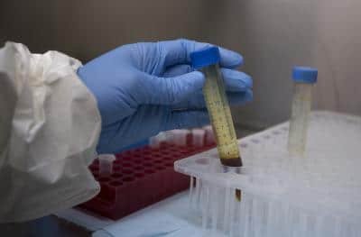 Covid 19 121 Labs Approved For Testing In India Says Icmr