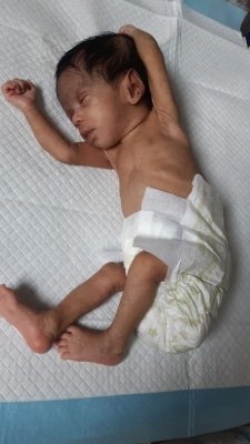 45 Day Old Baby Dies Of Covid 19 Over 30 Quarantined