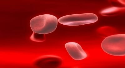 Can Iron Worsen Malaria Infection