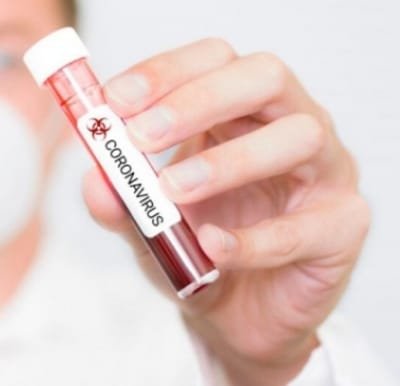 Icmr Issues Advisory For Rapid Antibody Test At Hotspots
