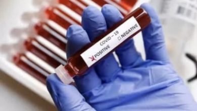 7 Dead 776 Test Positive In Tn For Coronavirus