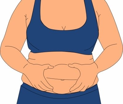 Teenage Obesity Bp May Lead To Prematurely Aged Arteries