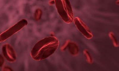 Blood Test Can Predict Severity Of Covid 19 Study