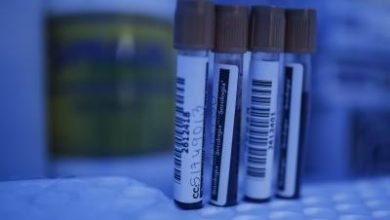 Blood Test To Detect Covid 19 Result In 20 Mins Study