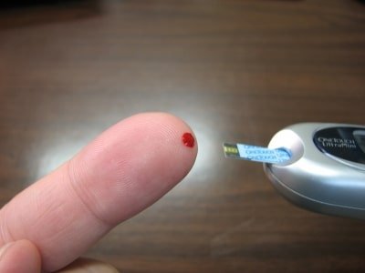 High Blood Sugar Ups Covid 19 Death Risk Study