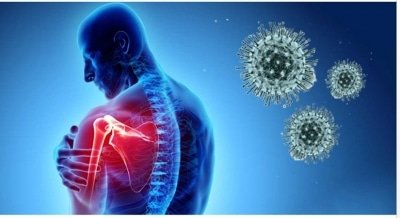 Neurological Disorder Among Covid Symptoms Case Presentation