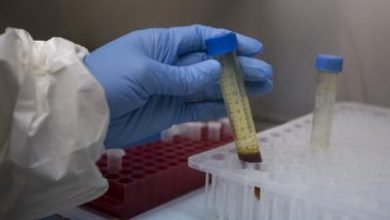 Researchers Identify Possible Drug Target For Prostate Cancer