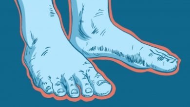 Study Supports Link Between Coronavirus And Covid Toes
