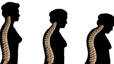 Vitamin D Deficiency Lead To Higher Osteoporosis Risk Study