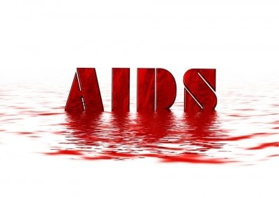 World To Miss 2020 Targets Against Aids Un