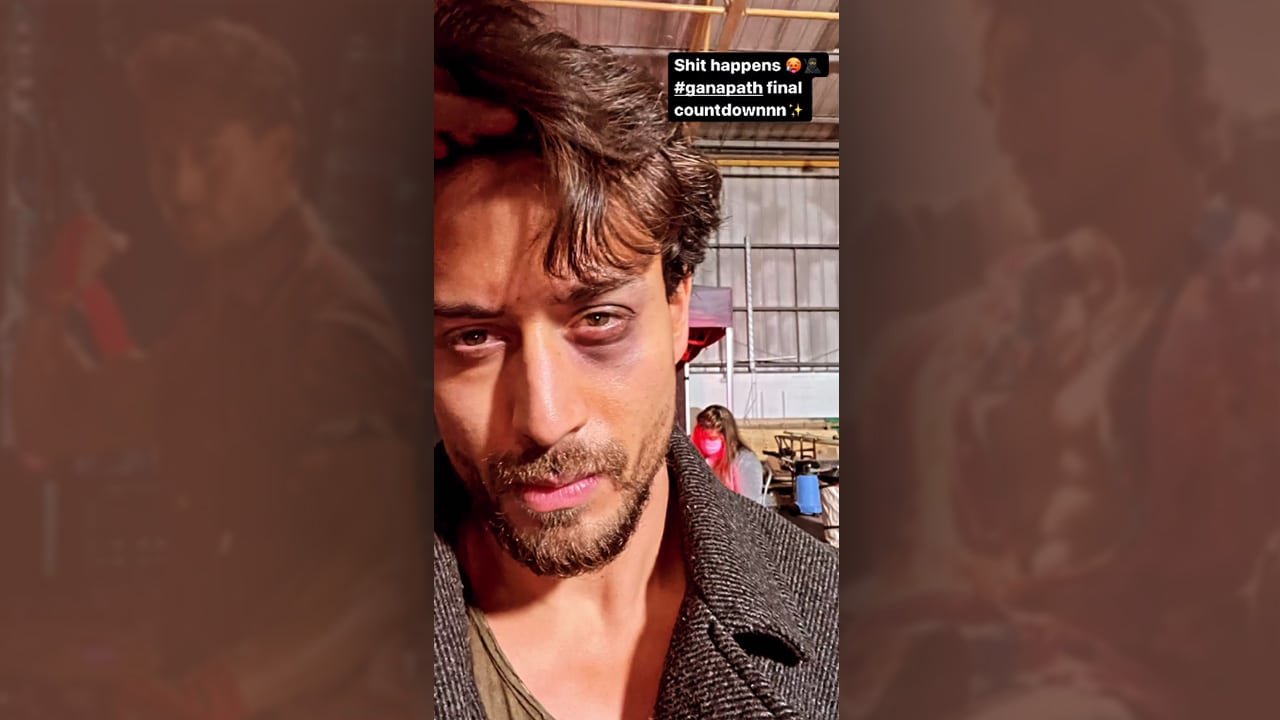 Eye Injury Tiger Shroff During Ganapath Shoot
