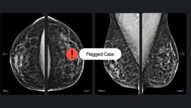 Google With I C A D To For A I Breast Cancer Screening Tools